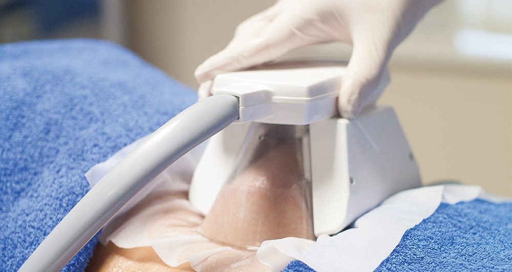 How Fat Freezing and HIFU Work Together? 2 Multiple Areas in One Session HIFU and Fat Freezing Hampton