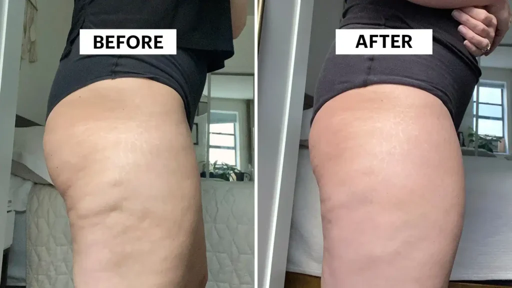 Do Toning Exercise Hampton Really Tackle Cellulite?