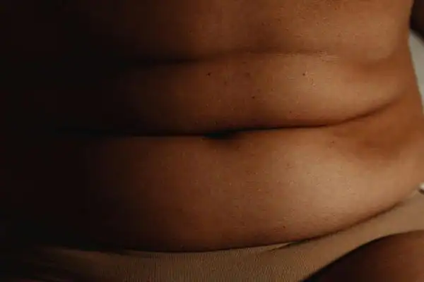 The Hidden Connection: How Stress Shapes Your Fitness and Body Composition 3 image of what stress can do on the stomach area and how Lipo 360 Hampton can help to change your body shape.